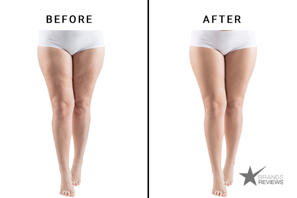 Body Merry Cellulite Cream Before and After