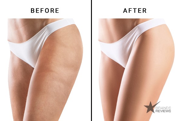 Clarins Cellulite Cream Before and After