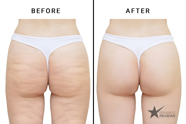 Coco & Eve Cellulite Cream Before and After