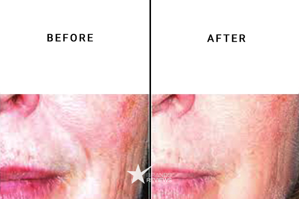 IS Clinical Anti-Aging Serum Before and After