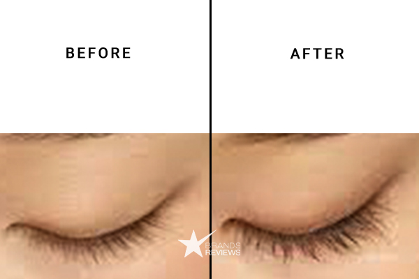 Latisse Eyelash Serum Before and After