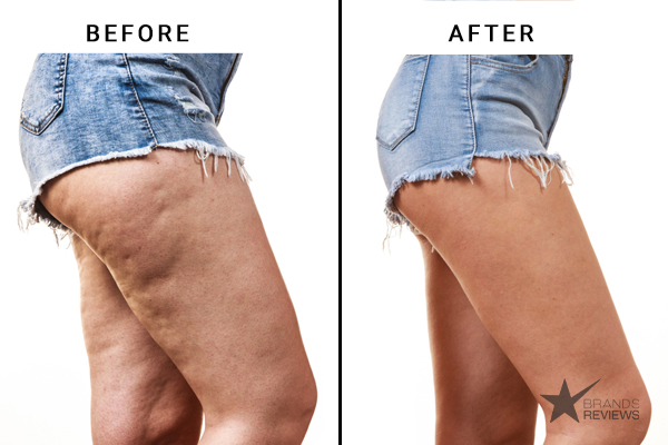 Nivea Cellulite Cream Before and After