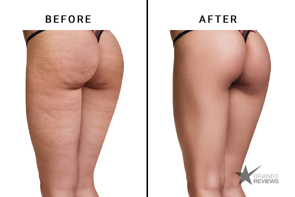 Soap & Glory Sit Tight Cellulite Cream Before and After