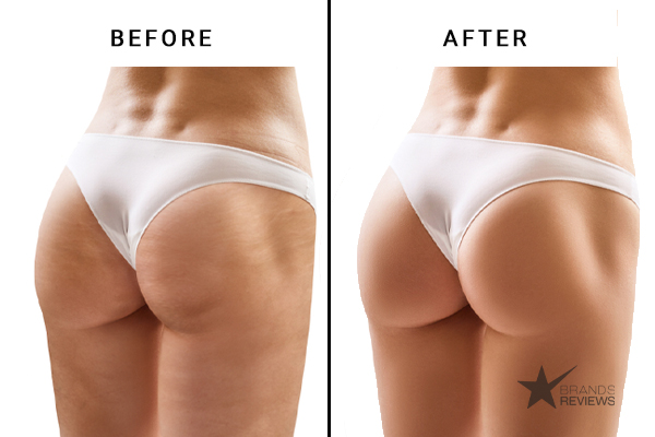 Sol De Janeiro Cellulite Cream Before and After