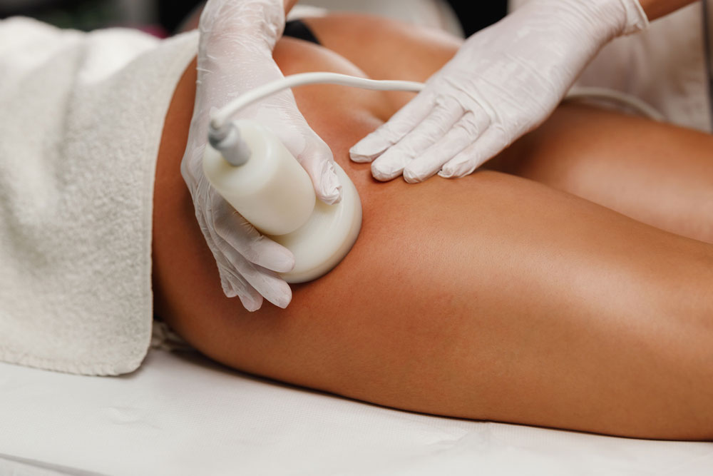 About CELLULITE TREATMENT