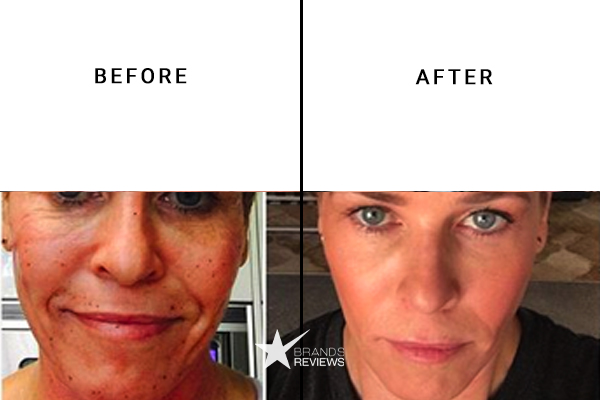 African Botanics Clay Mask Before and After