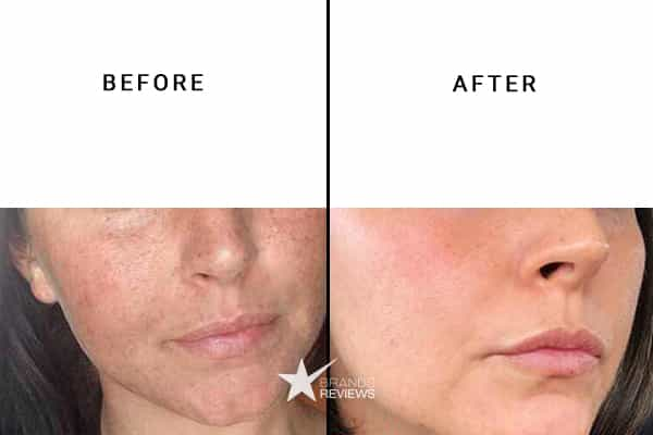 Algenist Collagen Serum Before and After