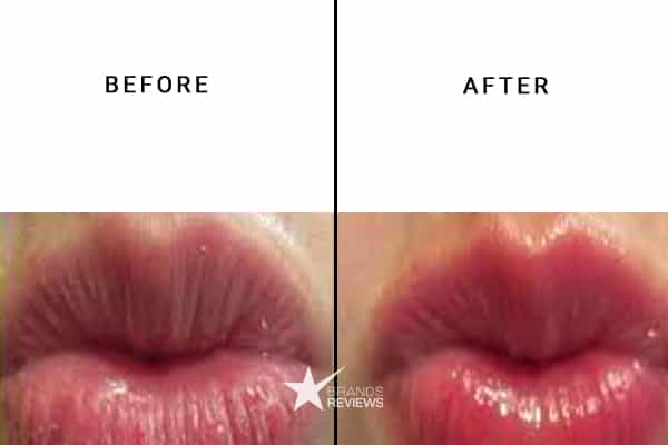 Augustinus ‌‌Bader Lip Balm Before and After