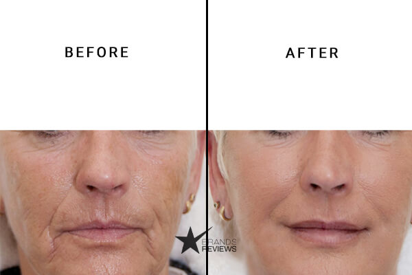 Avene Antioxidant Serum Before and After