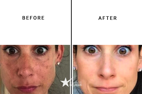 Aztec Secret Clay Mask Before and After