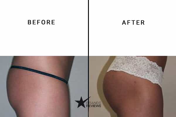 Booty Magic Butt Enhancement Cream Before and After