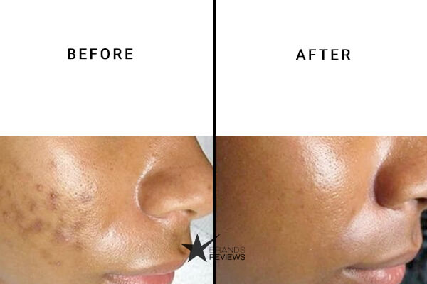 Botanika life cbd Face Cream Before and After