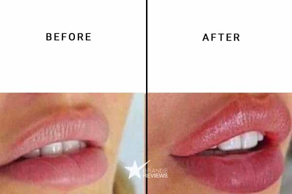 Buxom Lip Plumper Before and After