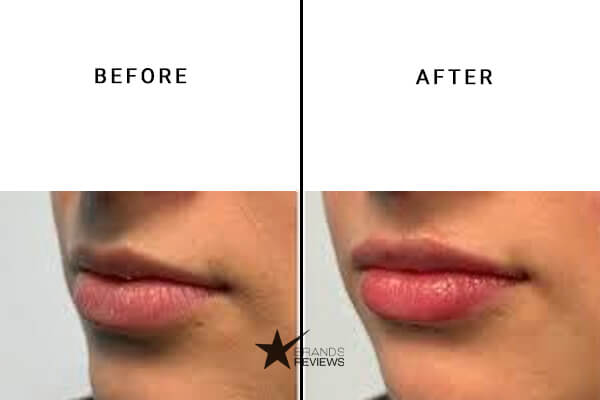 Cannuka CBD Lip Balm Before and After