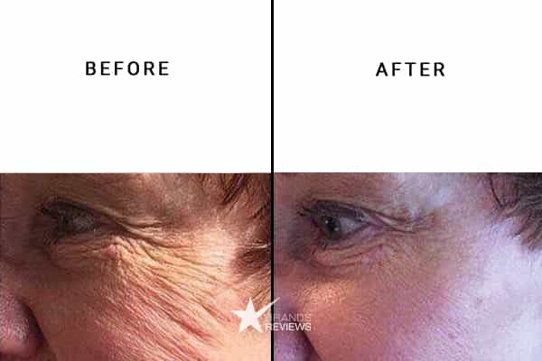 Caudalie Anti-Aging Serum Before and After