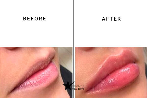 CBD Living Lip Balm Before and After