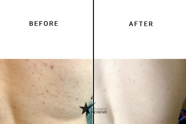 CBD American Shaman CBD body lotion Before and After