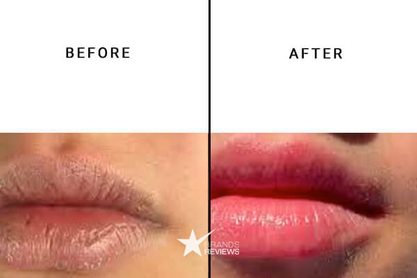 CBDistillery Lip Balm Before and After