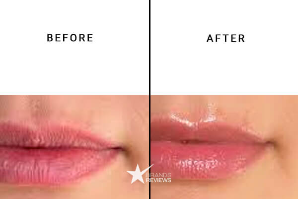 CbdMD Lip Balm Before and After