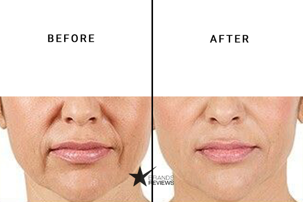 Cel Stem Cell Mask Before and After