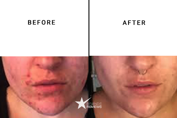 Cerave Face Cleanser Before and After