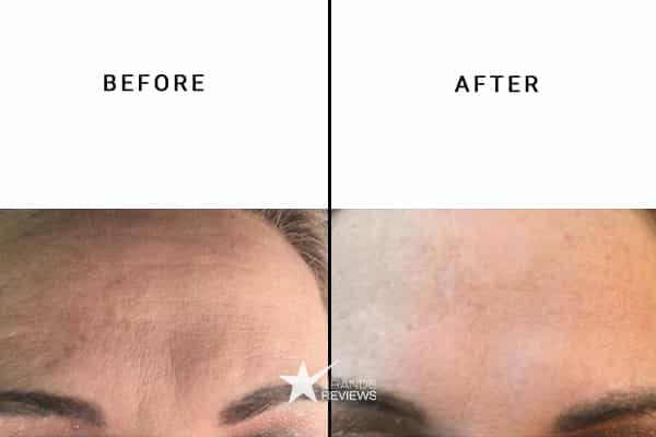 CeraVe Hyaluronic Acid Serum Before and After