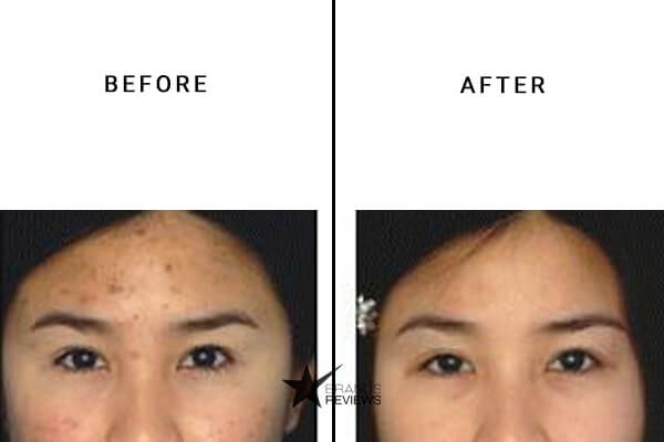 CeraVe Retinol Serum Before and After
