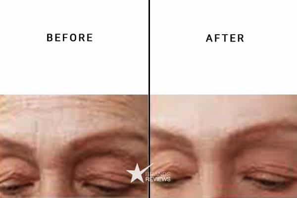 Cicatricure Anti-Aging Serum Before and After