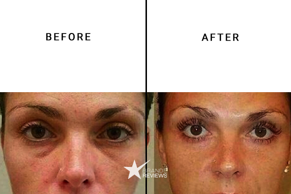 Clarins Eye Cream Before and After
