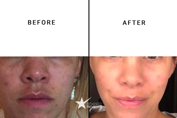 Clinique Face Scrub Before and After