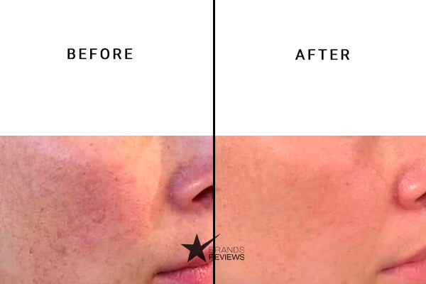 Cocokind Vitamin C Serum Before and After