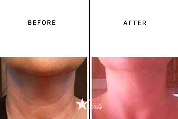 Colorescience Neck Firming Cream Before and After