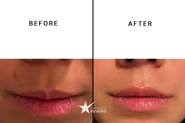 cureganics cbd lip balm Before and After