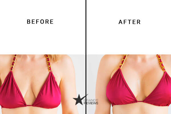CurvyPure Breast Enlargement Before and After