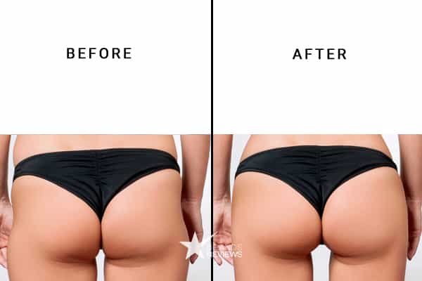 Curvypure Butt Enhancement Cream Before and After