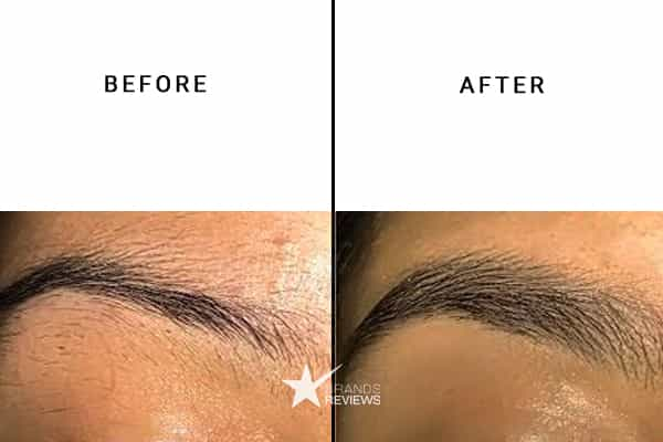 DenseBrow Eyebrow Growth Serum Before and After