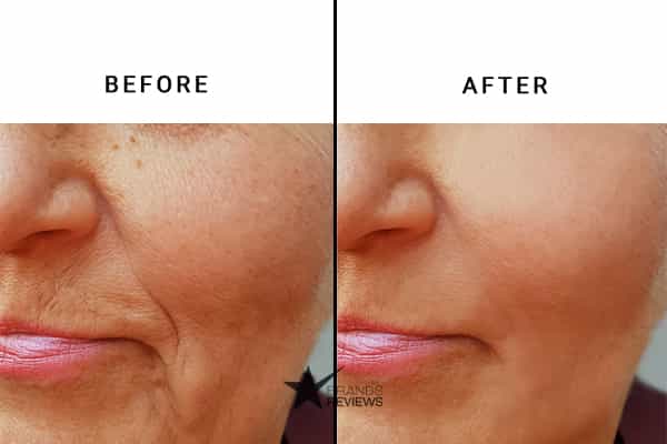 Derma RPX Anti-Aging Serum Before and After