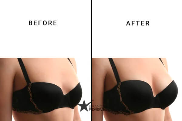 Divine Derriere Breast Enlargement Before and After