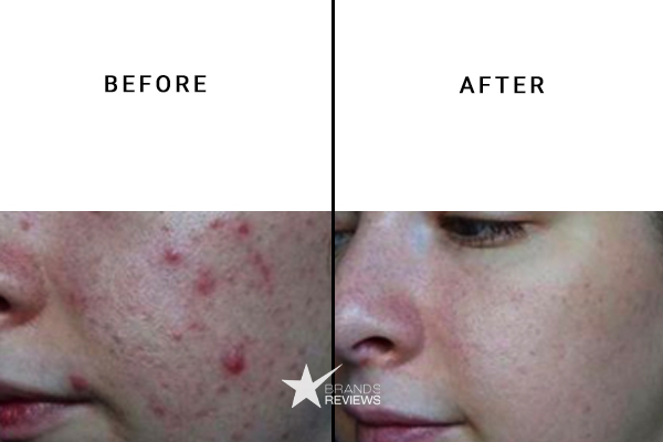 Dr Barbara Face Scrub Before and After