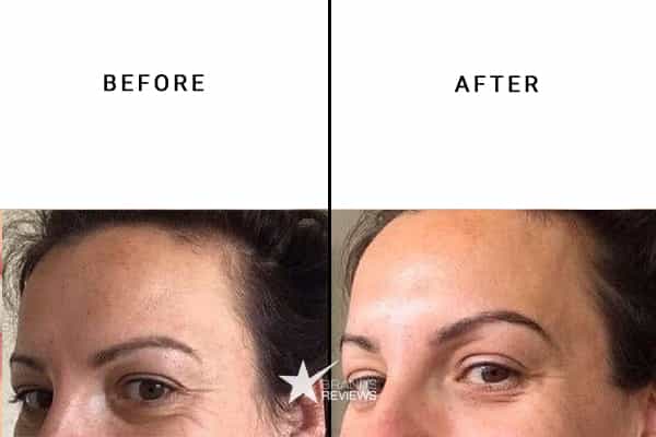 Dr. Brandt Collagen Serum Before and After