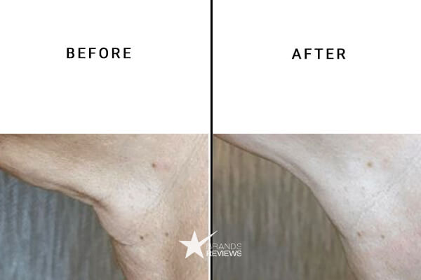 Dr. Brandt Neck Firming Cream Before and After