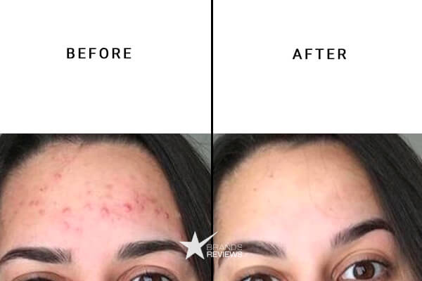 Dr. Dennis Gross Retinol Serum Before and After