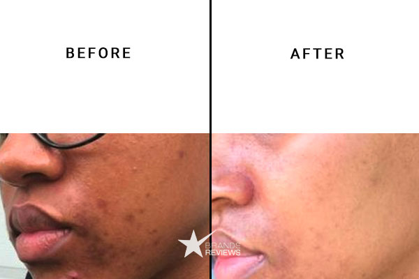Dr. Loretta Face Cleanser Before and After