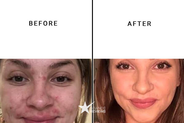 Drunk Elephant Retinol Cream Before and After