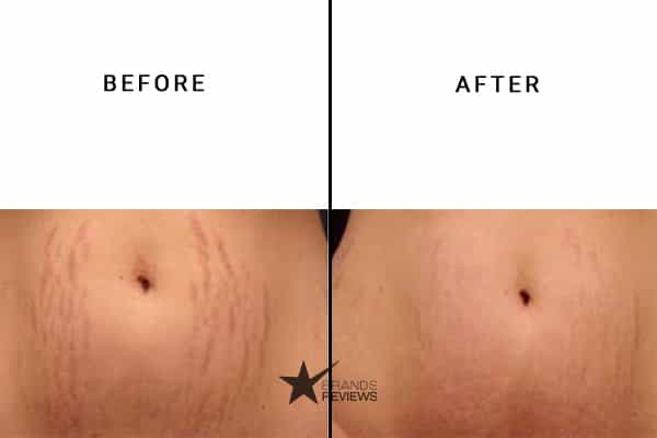 Earth Mama Stretch Mark Cream Before and After