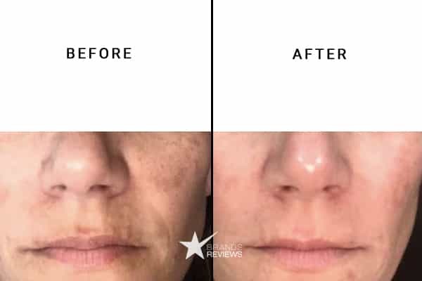 Elemis Collagen Serum Before and After
