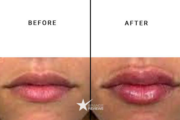 Elixinol CBD lip balm before and After