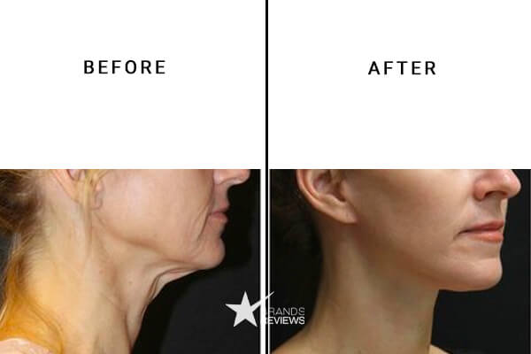 Elizabeth Arden Neck Firming Cream Before and After