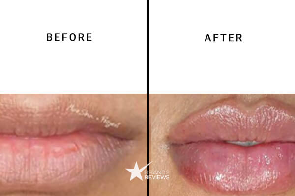 Endoca CBD lip Balm Before and After