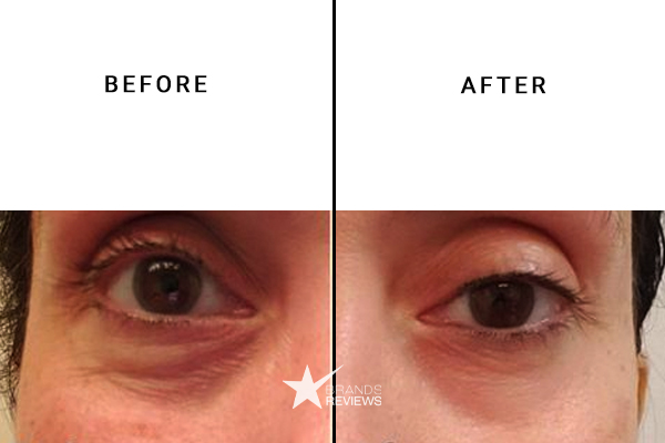 Estee Lauder Eye Cream Before and After
